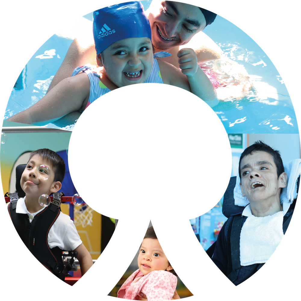 ¿Qué es la parálisis?